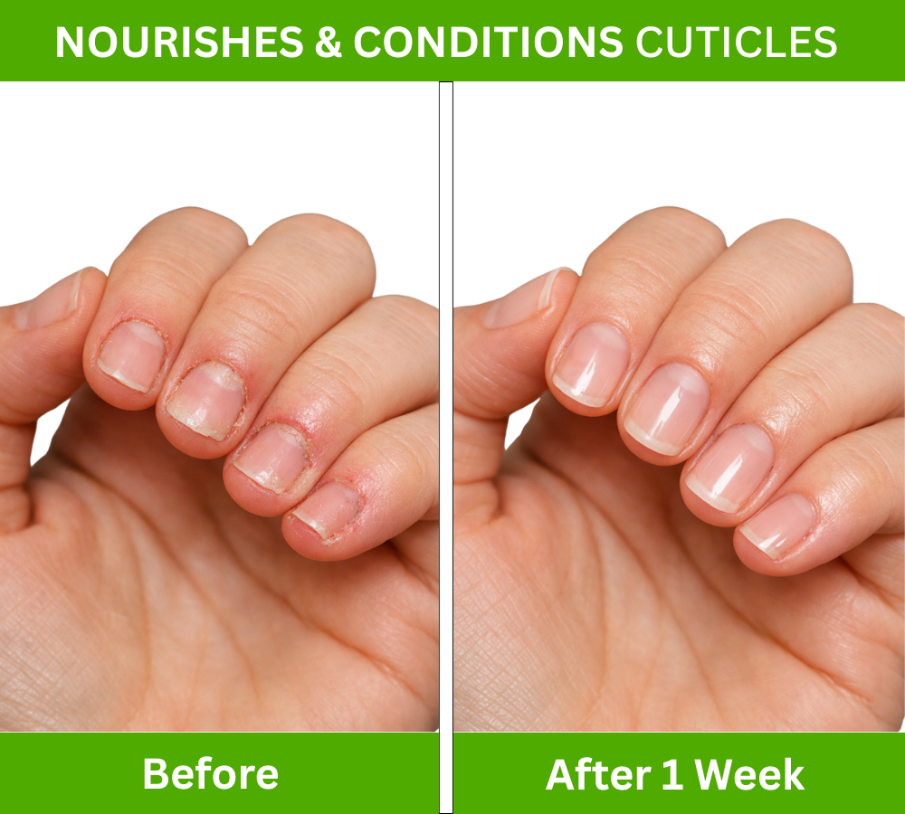 Nail & Cuticle Oil For Growth & Strengthening