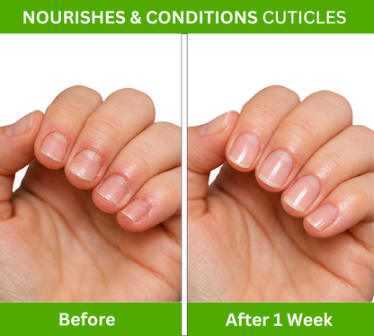 Nail & Cuticle Oil For Growth & Strengthening